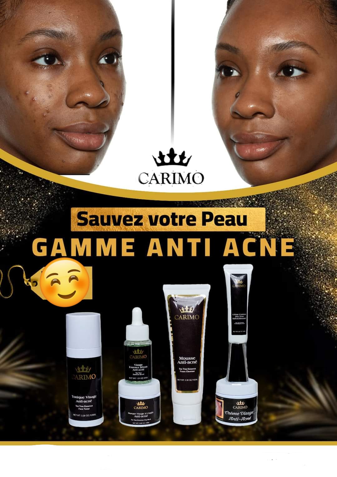 Gamme anti acné